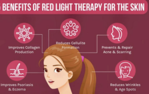 What are the Benefits of Red Light Therapy?